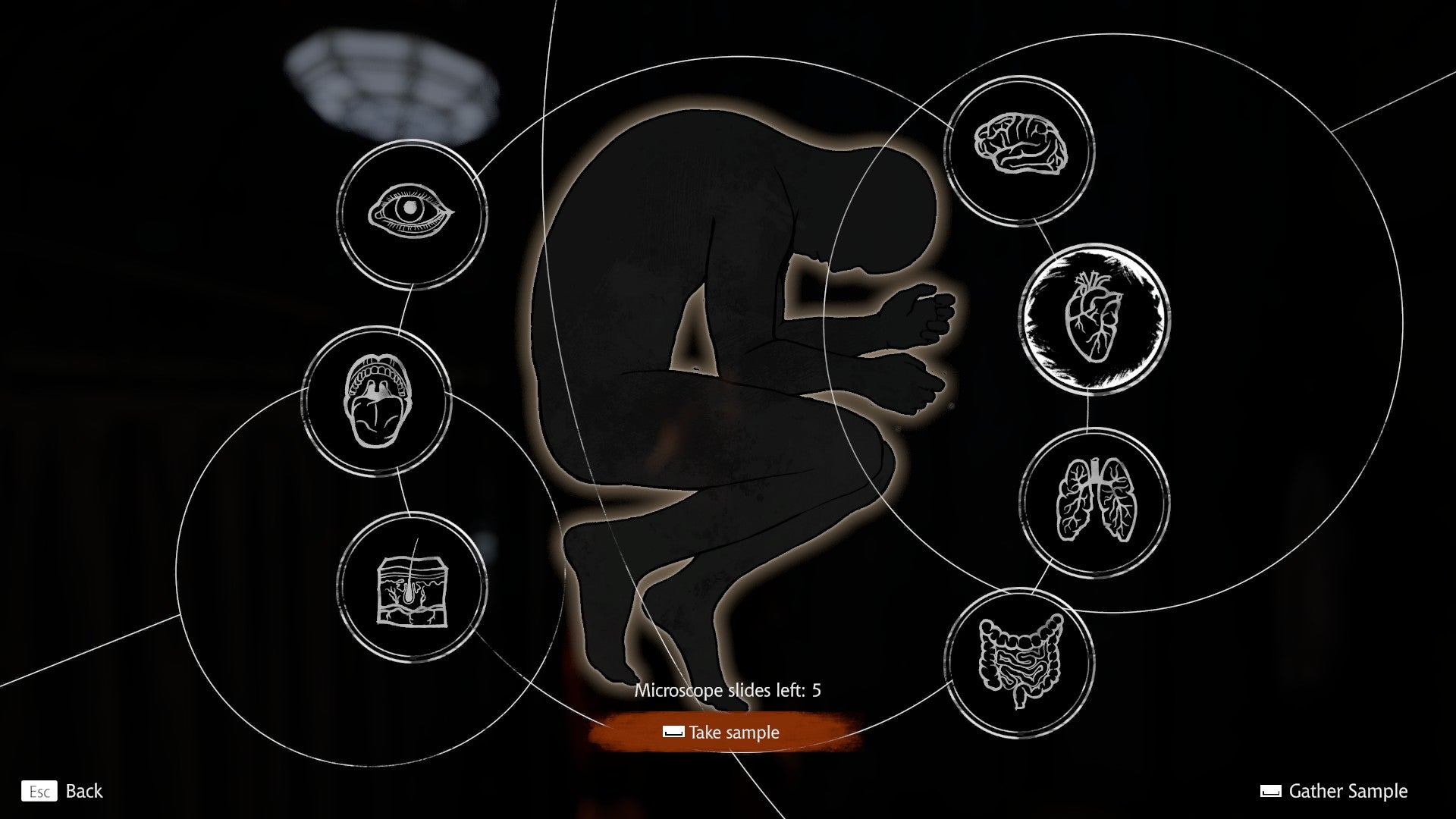 A screen for extracting samples from patients in Pathologic 3, showing a silhouette of a human curled into a fetal position. - 7