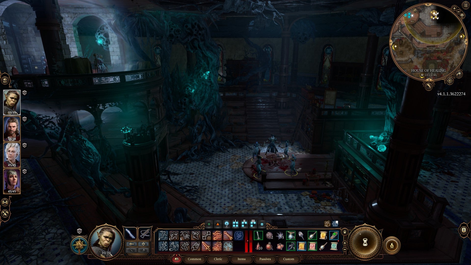 Baldur&rsquo;s Gate 3 screenshot showing: The party, high up on a balcony, overlook a sinister surgery