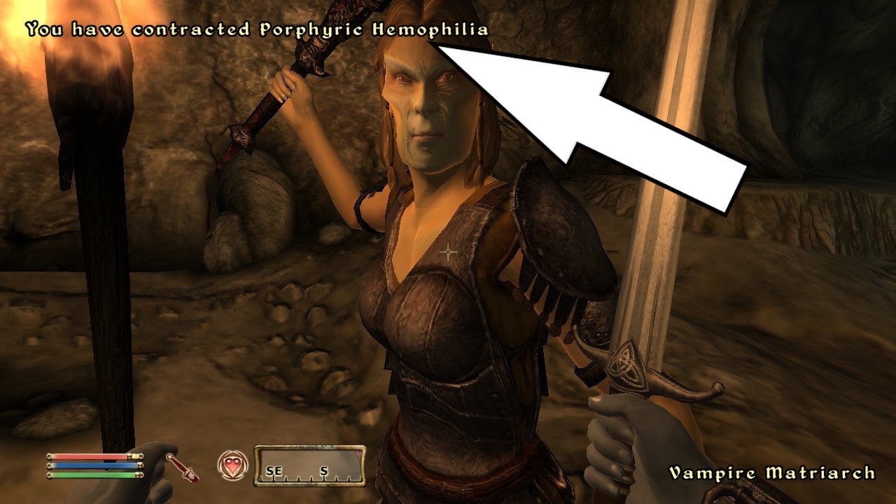 Arrow pointing to text telling you that you&rsquo;ve caught Porphyric Hemophilia in Oblivion.
