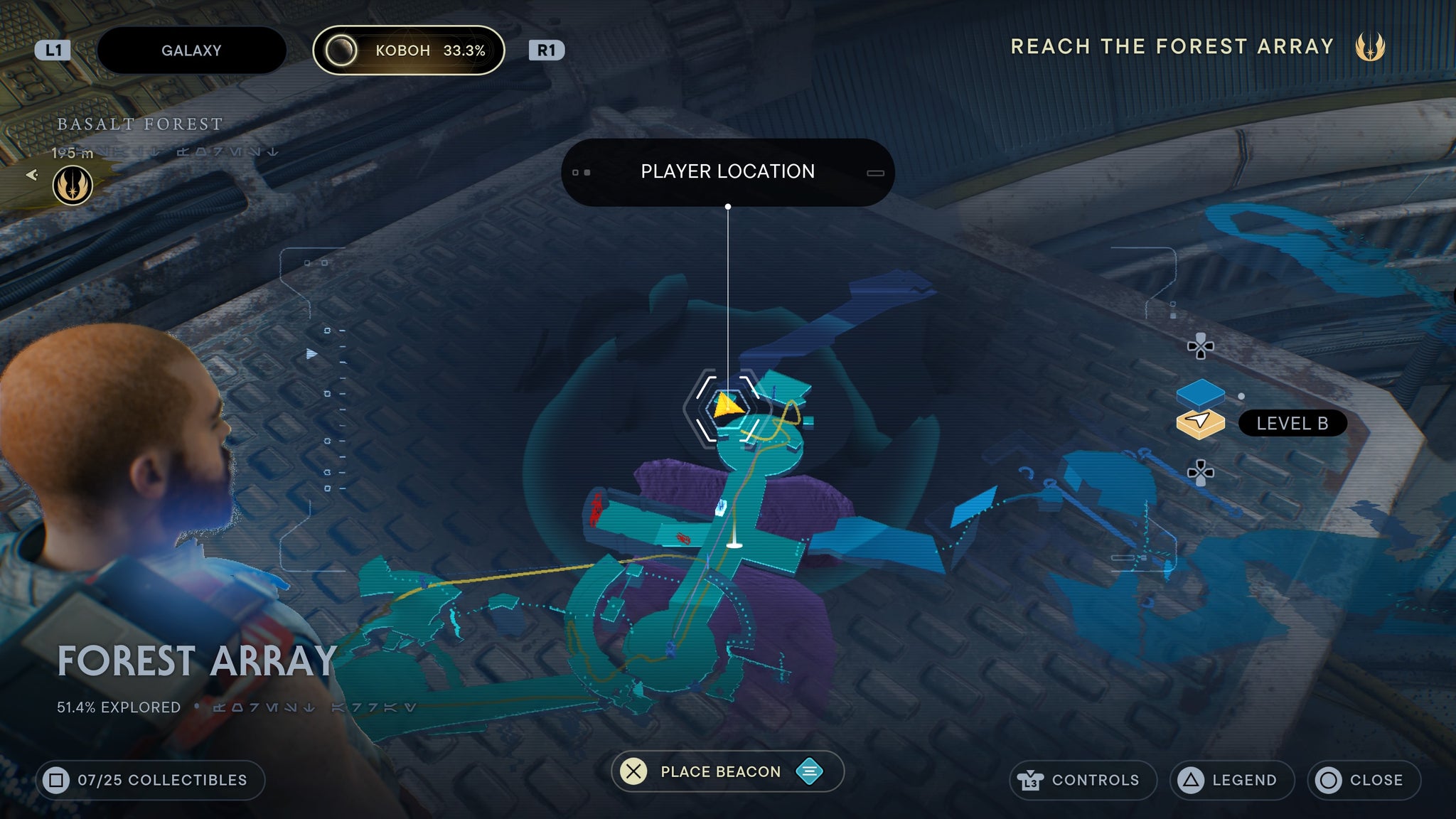 Forest Array treasure 1 - 62