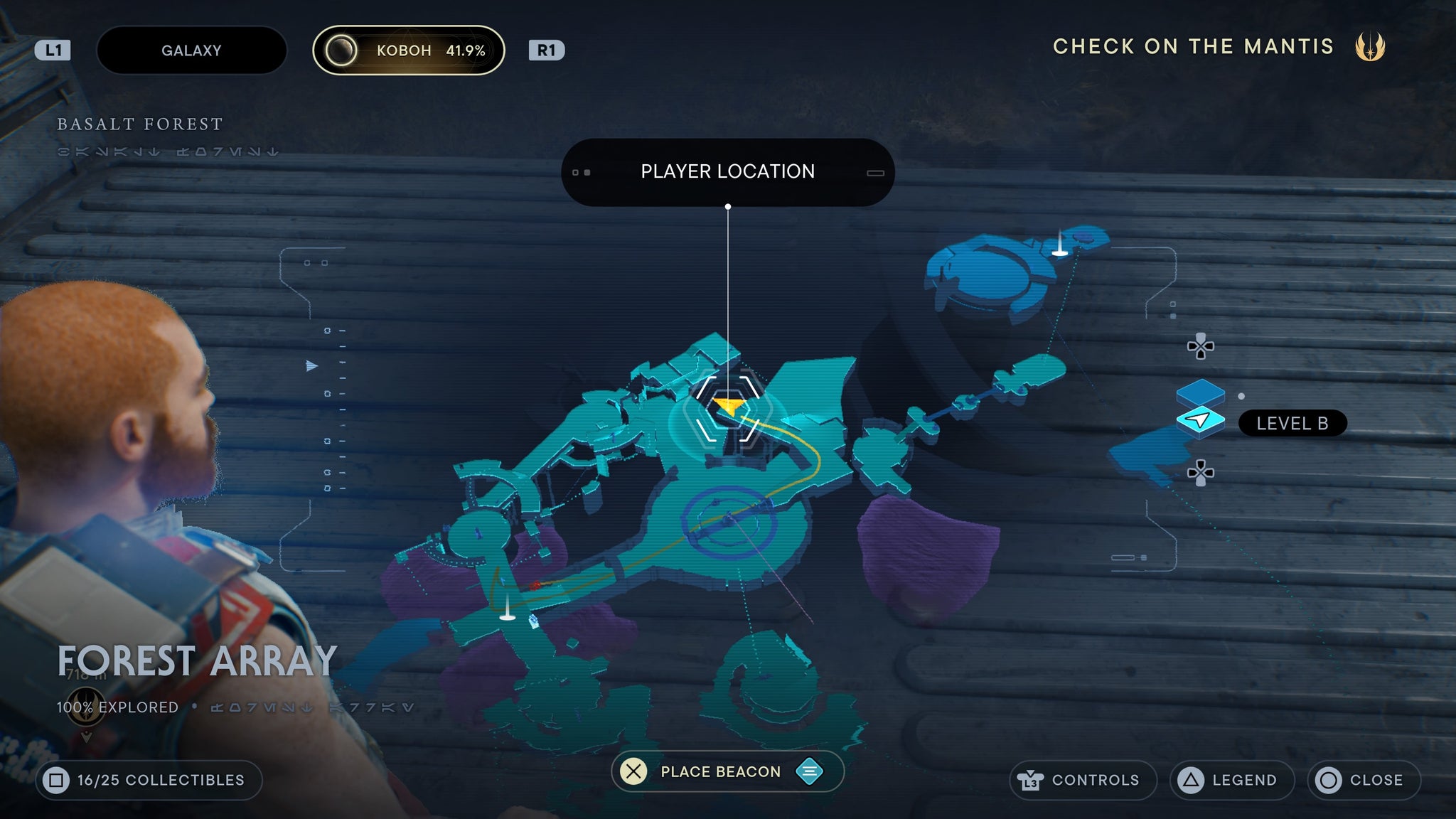 Forest Array treasure 3 - 64