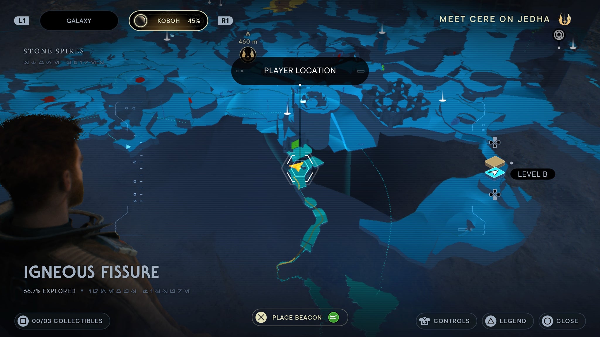 Ingenious Fissure scan 1 - 108