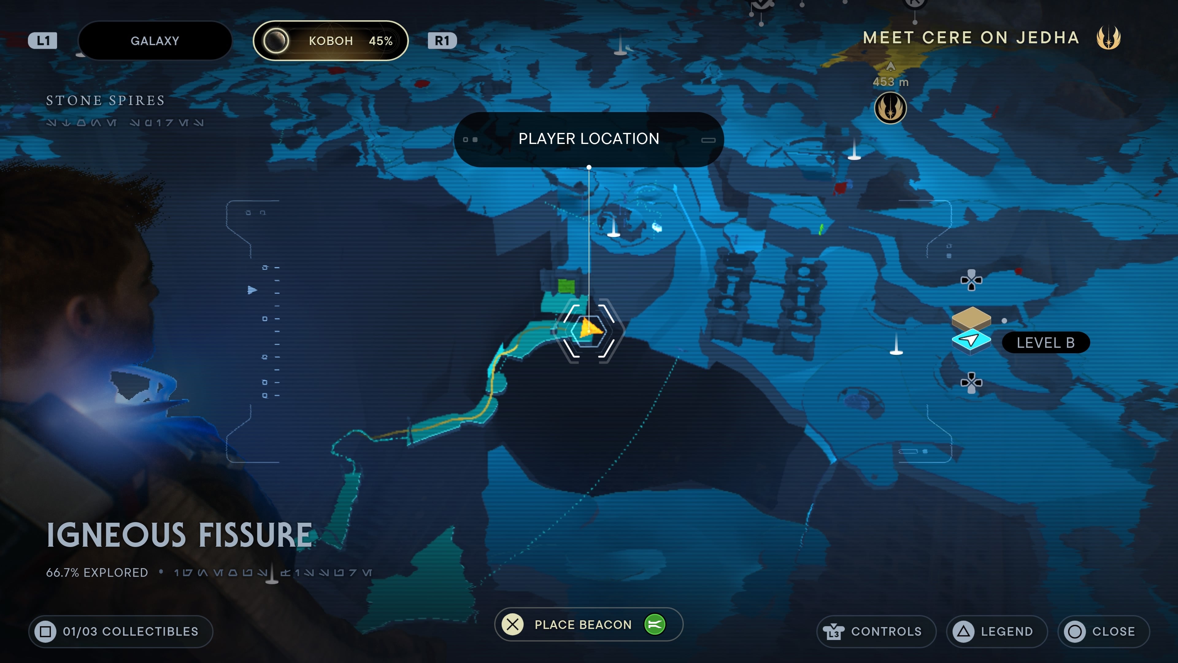 Ingenious Fissure scan 2