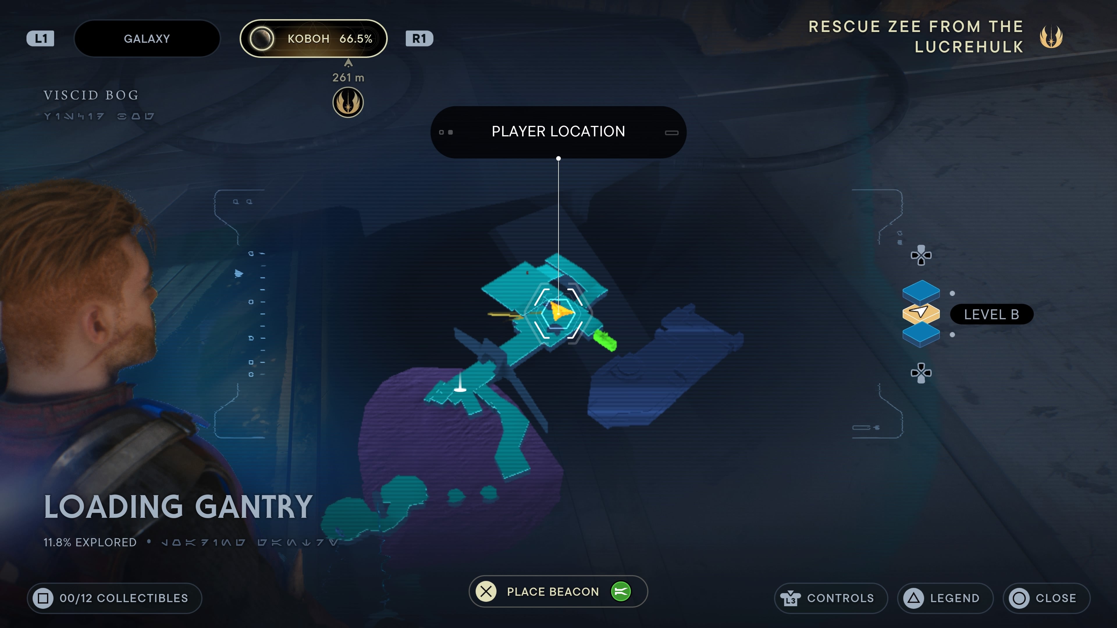 Loading Gantry scan 1