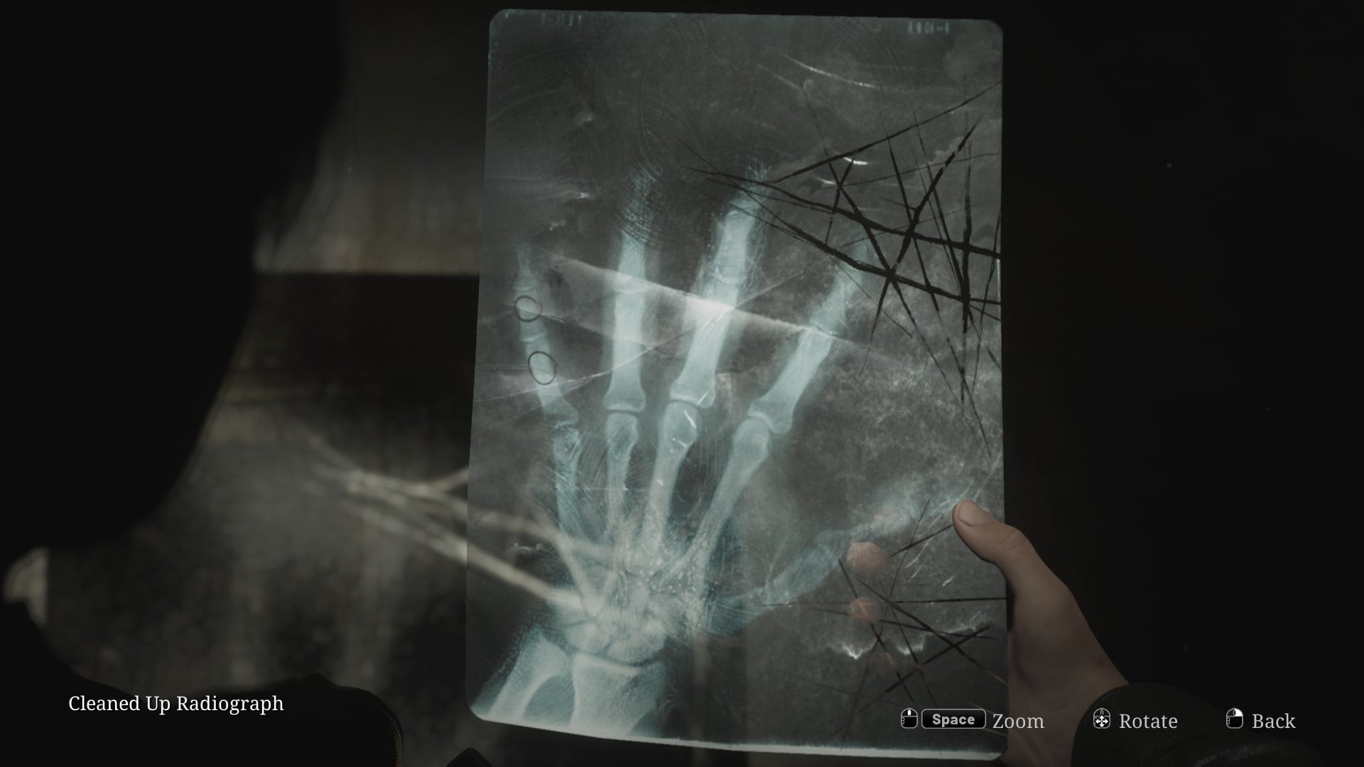 James holds a cleaned up radiograph in the Silent Hill 2 remake - 3