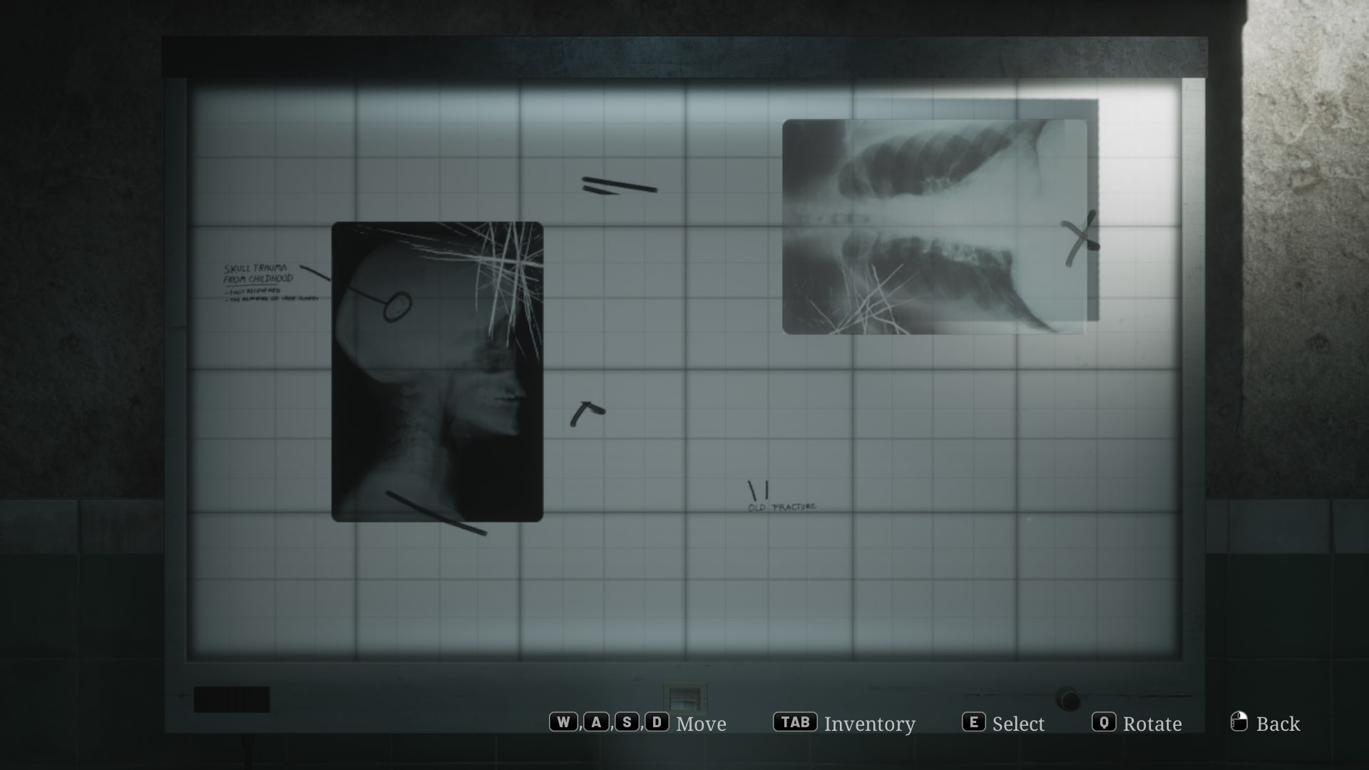 James looks at the X-Ray Viewer of Brookhaven Hospital in the Silent Hill 2 remake - 1