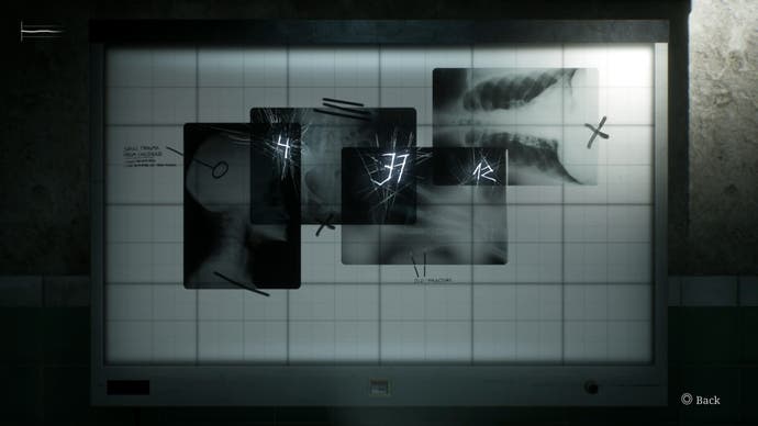 The solution to the X-ray viewer puzzle on Standard difficulty in Silent Hill 2.
