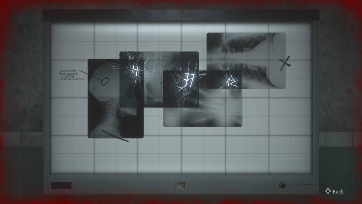 Silent Hill 2 X-Ray puzzle solution | Eurogamer.net