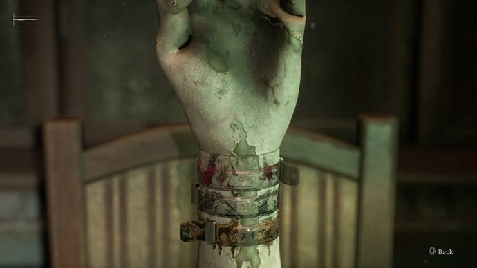 A hand statue with three medical bracelets attached in Silent Hill 2.