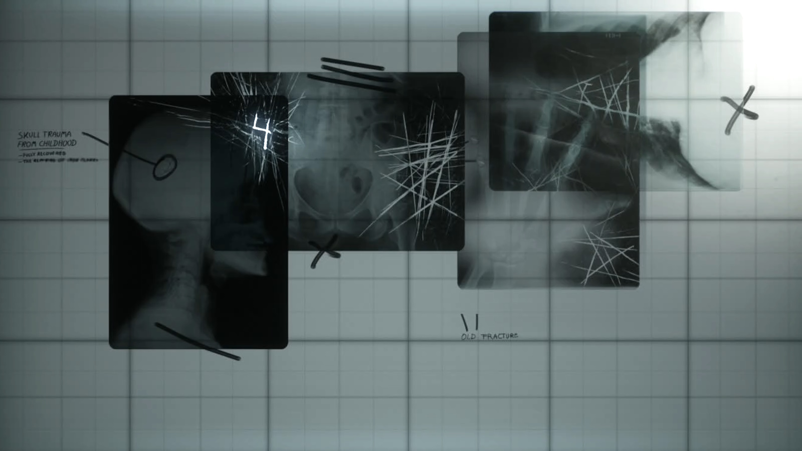 Silent Hill 2 X-Ray puzzle solution | Eurogamer.net