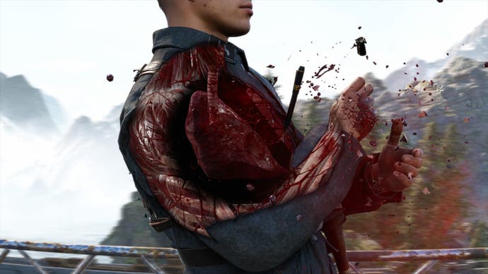 A glorious bloody X -ray killed a officer who was torn by a lungs who were sniped by a sniper elite to tear
