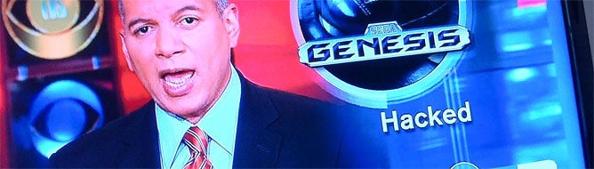 CBS: 