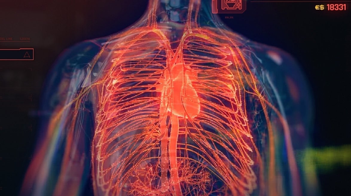 Cyberpunk 2077 Cyberware uitgelegd - Cyberware kopen, installeren, wisselen en Mods