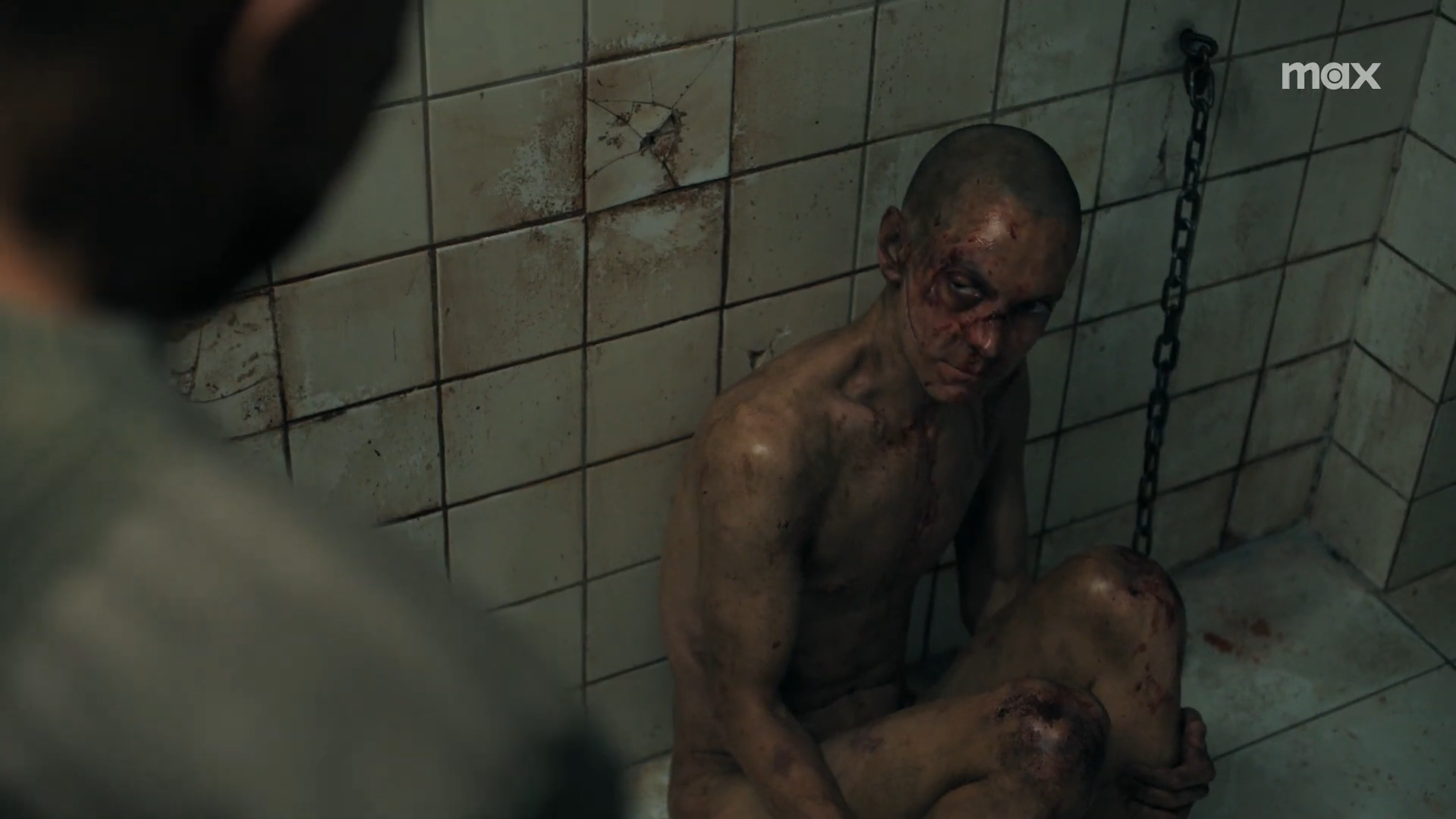 Captured Scar in TLOU season two