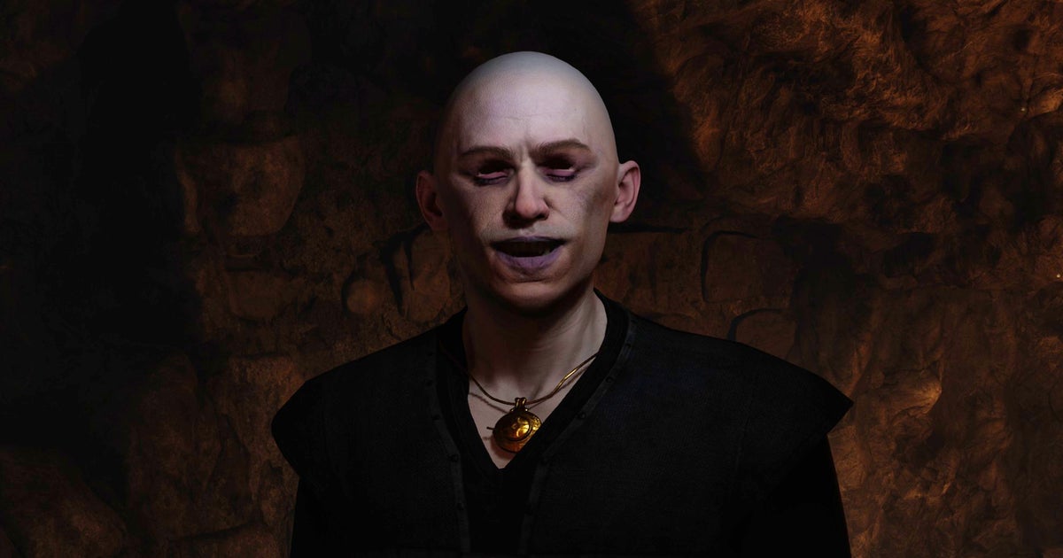 Oblivion Remastered has two updates coming, and one will save us from sudden glitchy vampire baldness Oblivion Remastered has two updates coming, and one will save us from sudden glitchy vampire baldness