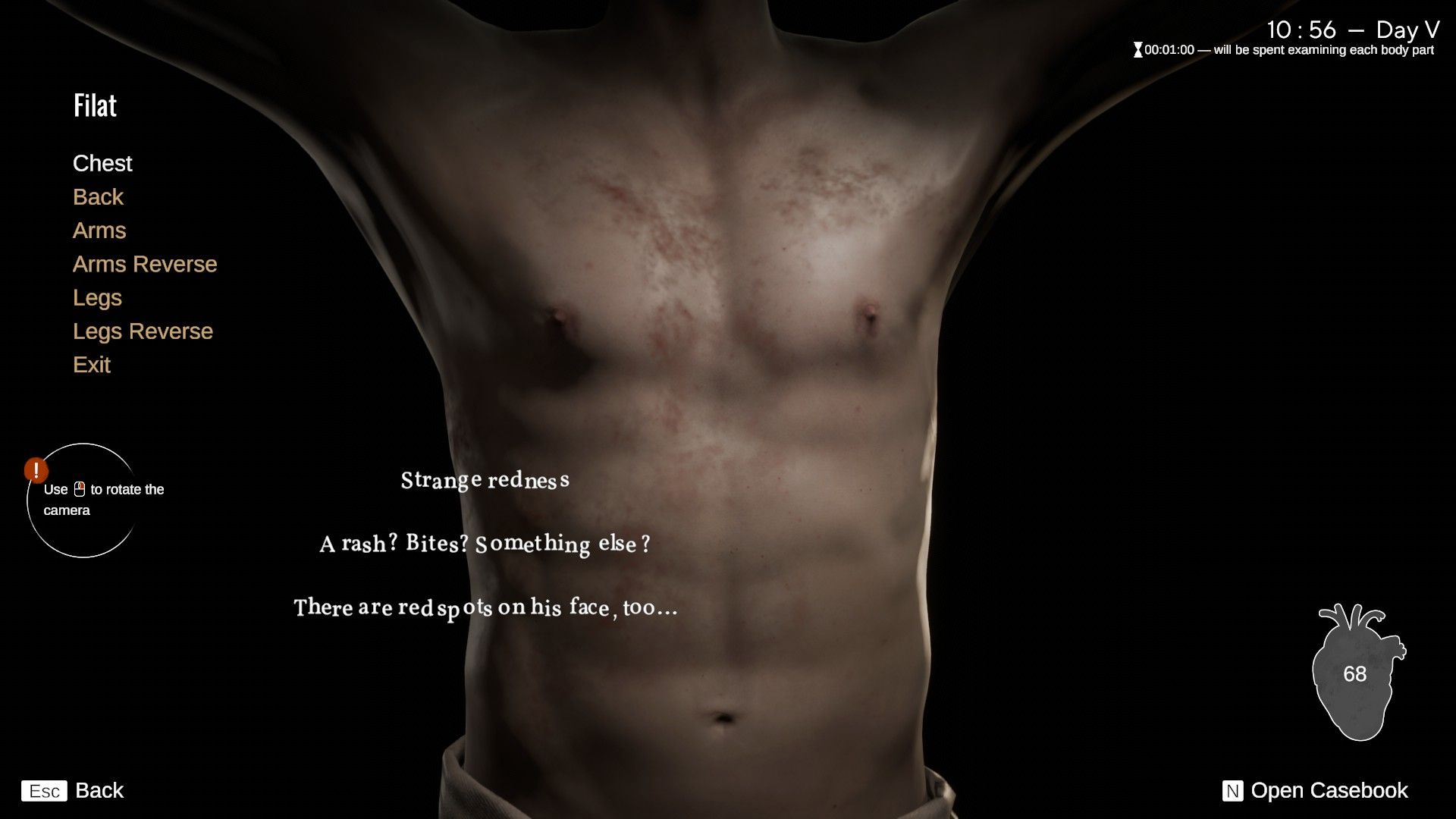 The player examines the chest of a patient, encountering red marks. - 4
