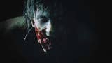 Resident Evil 2: seis trucos para sobrevivir a la plaga zombi