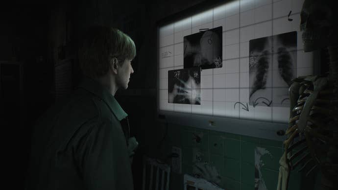 Screenshot from Silent Hill 2 remake showing James Sunderland looking at a selection of X-Rays