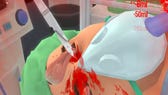 Surgeon Simulator 2013 clip shows eye surgery on iPad