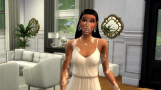 The Sims 4 reforça a inclusividade introduzindo vitiligo