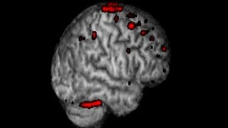 Study: Brain MRI while gaming allows scientists to "map the ethereal concept of attention"