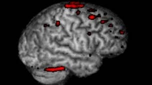 Study: Brain MRI while gaming allows scientists to "map the ethereal concept of attention"