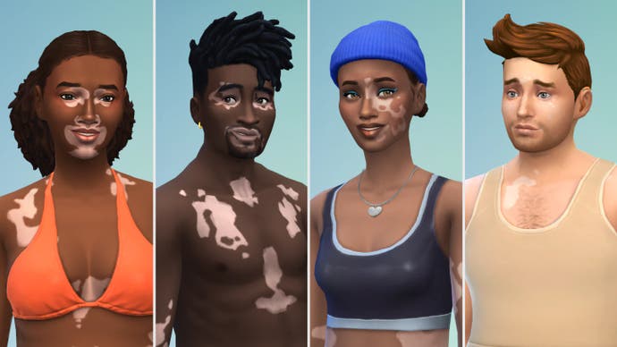 Vitiligo examples in The Sims 4 (face)