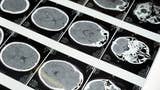 Komórki mózgowe wyhodowane w laboratorium grają w Pong